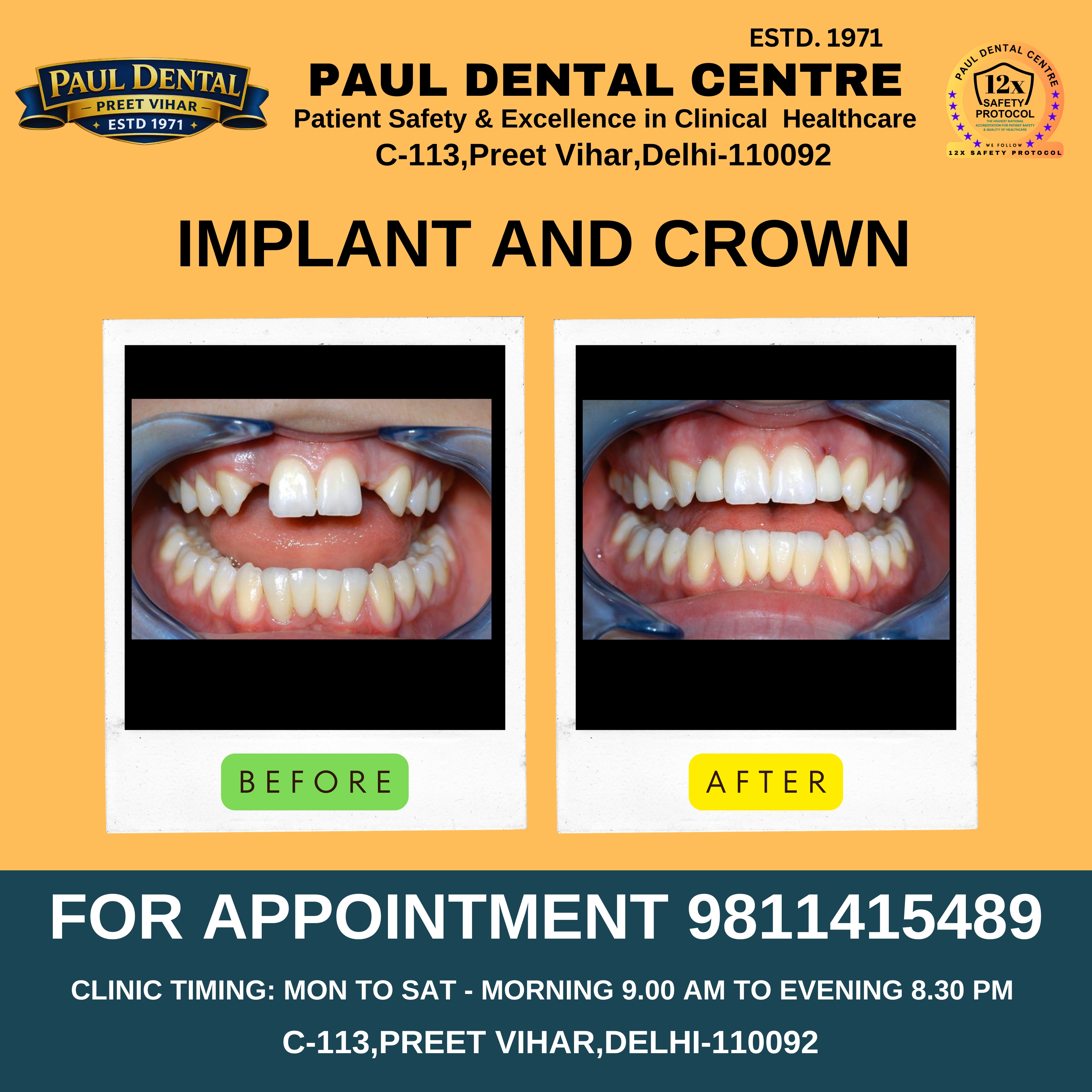 Case 20 – Paul Dental Center